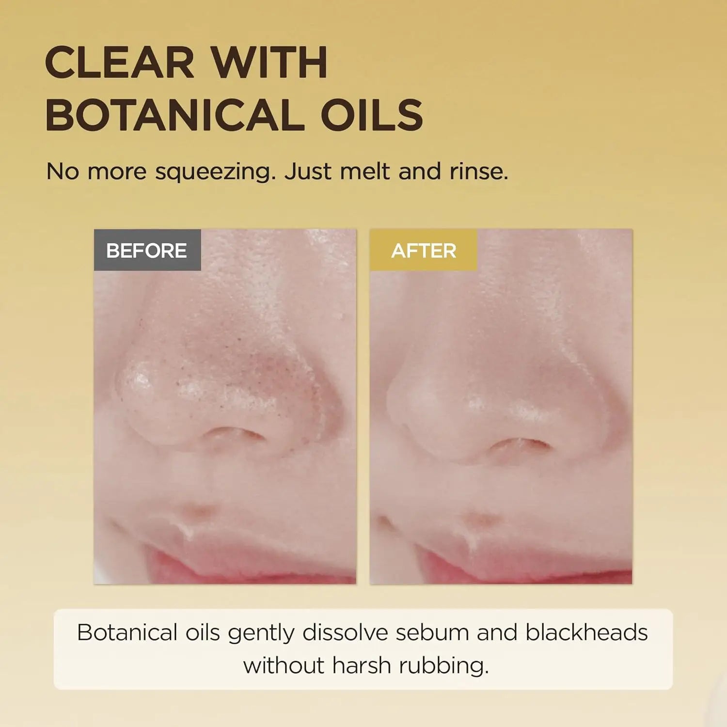 SKIN1004 Madagascar Centella Light Cleansing Oil 6.76 Fl.oz, 200ml | Gentle Oil Cleanser for Face, Korean Facial Cleanser