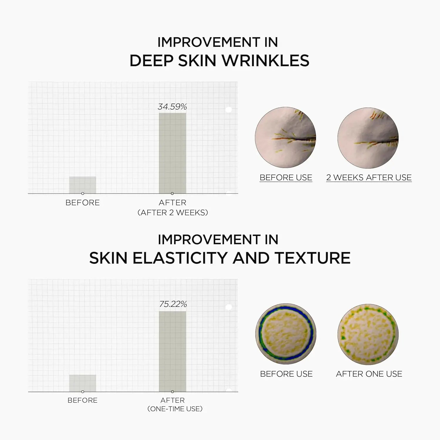 SKIN1004 Retinol 0.2% Boosting Shot Ampoule, Face Serum for Skin Elasticity, Facial Spicule Serum with Retinol & Retinal